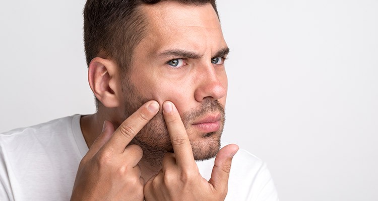 با روش های سنتی جوش هاتو درمان کن!