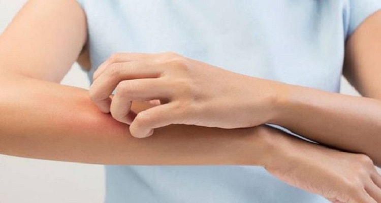 درمان حساسیت پوستی در طب جدید