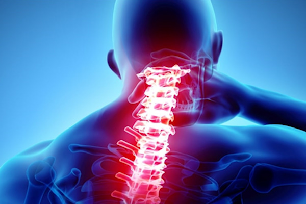 درمان درد گردن در طب سنتی