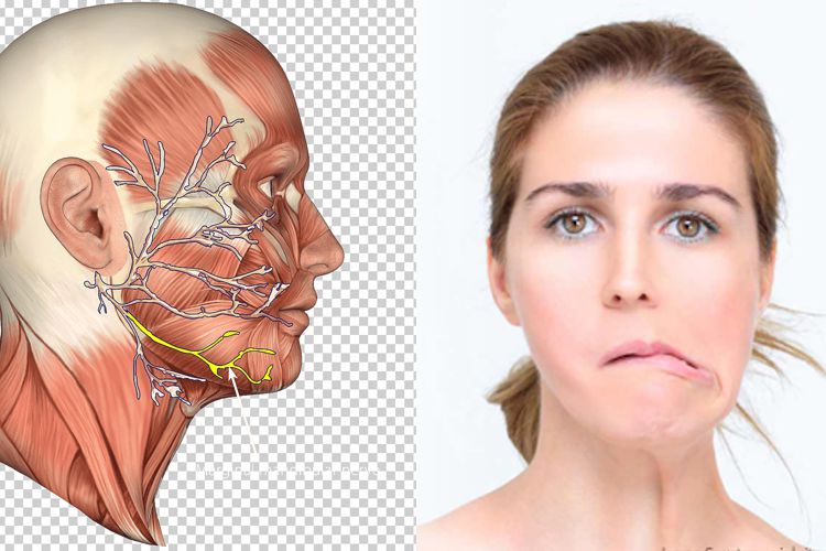 لقوه و توصیه های طب سنتی