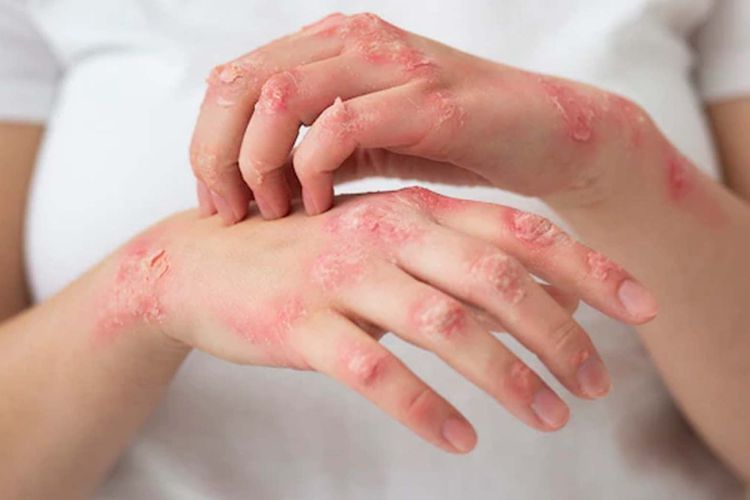 17 بیماری رایج پوست و نسخ طب سنتی