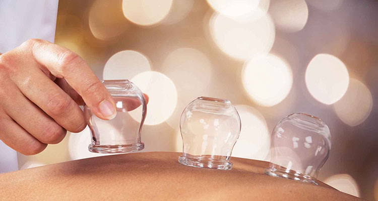 جزوه جامع اعمال یداوی (حجامت) طبایع