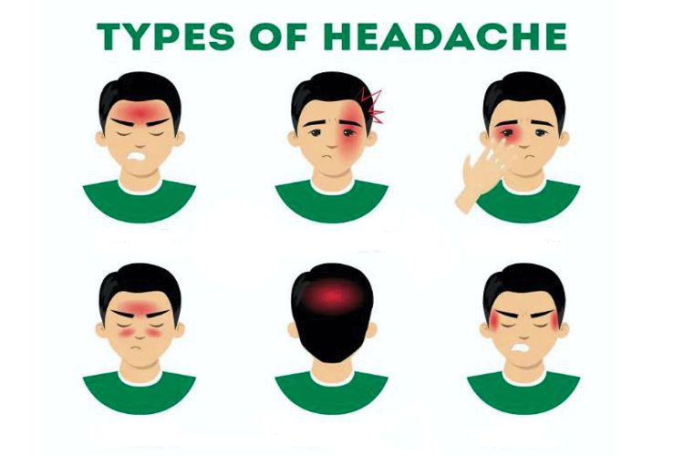 انواع سردرد بر اساس ناحیه درد و مزاج