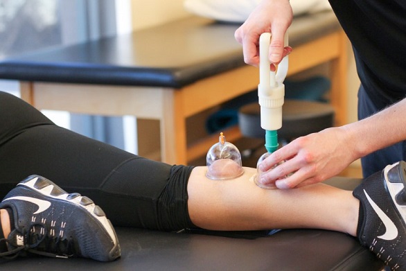 آشنایی با انواع حجامت پا در طب سنتی