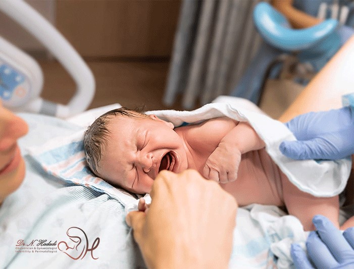 زایمان طبیعی