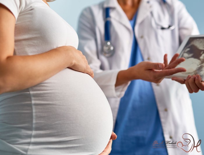 زایمان طبیعی