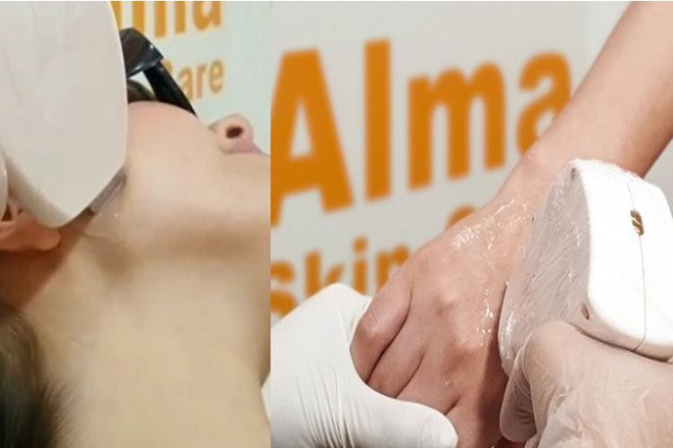 آیا از پرسیدن این سوالات درباره لیزر موهای زائد خجالت می کشید؟!