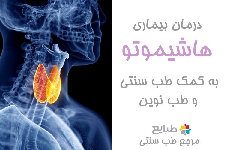 روش های درمانی بیماری هاشیموتو با طب سنتی و طب نوین