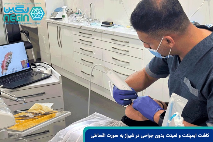 کاشت ایمپلنت و لمینت بدون جراحی در شیراز به صورت اقساطی