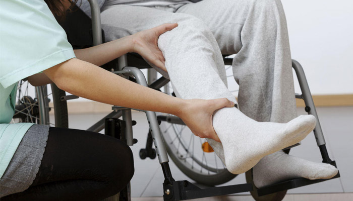 تعویض مفصل مچ پا (آرتروپلاستی مچ پا): هر آنچه باید بدانید 1 آرتروپلاستی