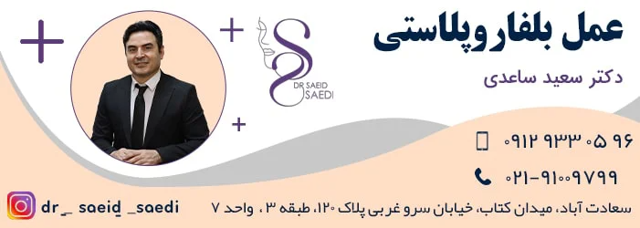 بلفاروپلاستی