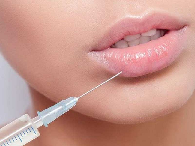 مراقبت های بعد از تزریق ژل لب 1 مراقبت های بعد از تزریق ژل لب