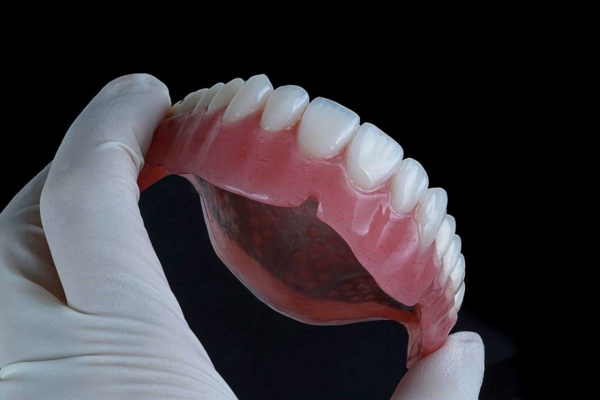 بهترین روش کاشت دندان کدامست؟ 1 کاشت دندان