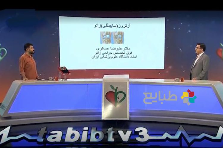 آرتروز زانو، پیشگیری و درمان