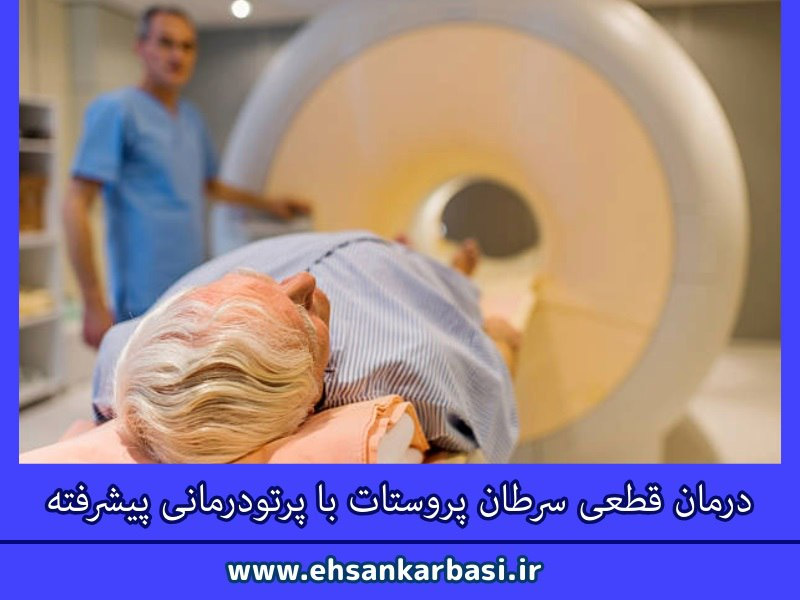 درمان قطعی سرطان پروستات بدخیم با پرتو درمانی پیشرفته: امیدی برای بیماران