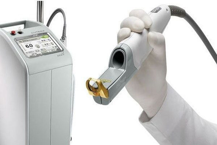 لیزر موهای زائد