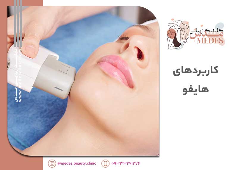 معرفی هایفو (HIFU)