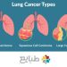 سرطان ریه