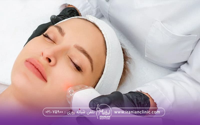 لیزر موهای زائد