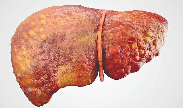 بررسی تخصصی بیماریهای گوارشی با خدمات پیشرفته در کلینیک حکمت شیراز 1 بیماری گوارشی