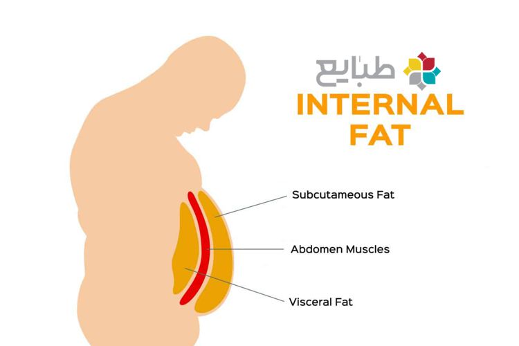 رفع چربی دور شکم با طب سنتی