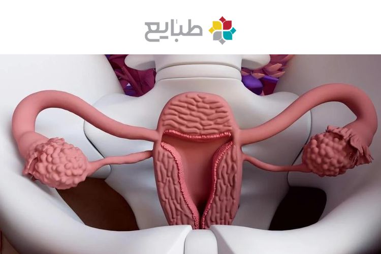 درمان سردی رحم با طب سنتی