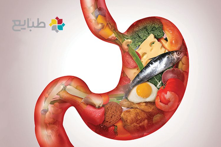 انواع سوء مزاج معده و درمان آن