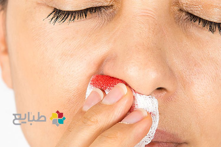 خون دماغ شدن از دیدگاه طب سنتی