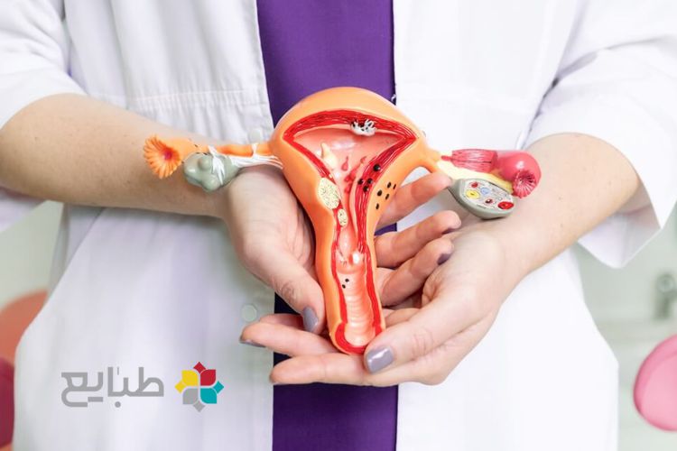 سلامت رحم در طب سنتی (بخش دوم)