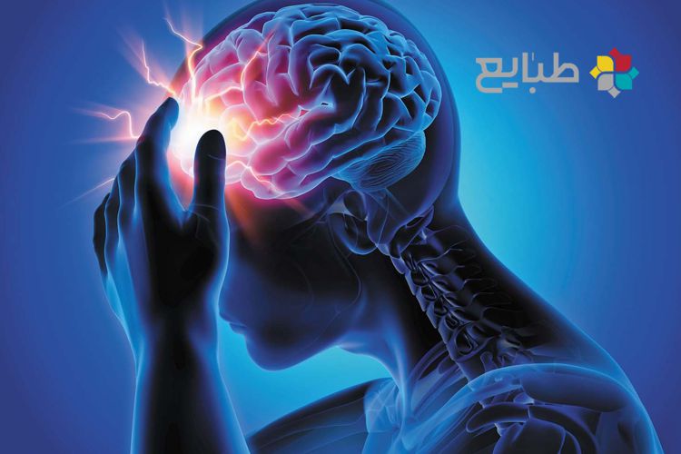 سردرد و انواع آن در طب سنتی ایرانی